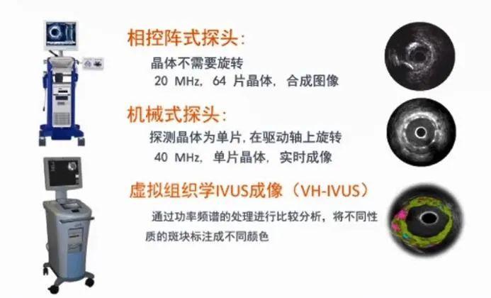 GW最新虚拟系统，重塑虚拟化体验的探索之旅